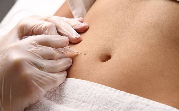 Carboxiterapia