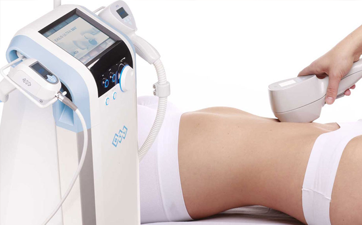  EXILIS 360 ULTRA